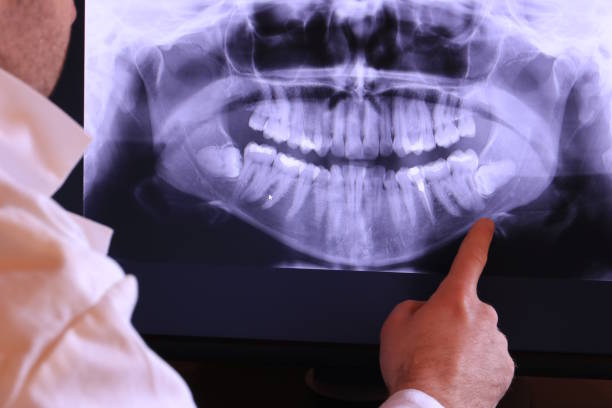Best Pediatric Emergency Dentist in Columbus Junction, IA