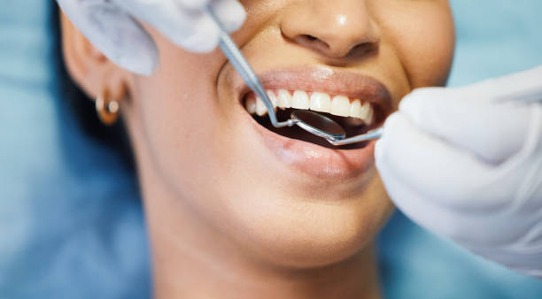 Best Emergency Dental Extractions in Columbus Junction, IA