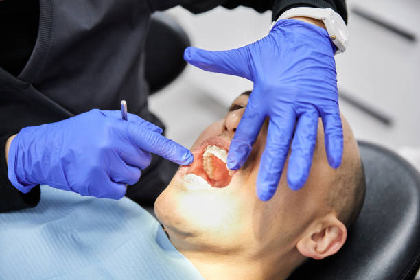 Best Emergency Dentist for Knocked-Out Tooth in Columbus Junction, IA